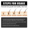 Hair Micro 540 Roller Derma Roller Dermaroller Titanium Promot Hair Regrowth Beard Growth Anti Hair Loss Treat Thinning Receding - China - 01